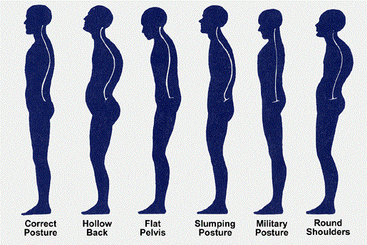 Open up Those Rounded Shoulders! - VerticAlign Posture & Ergonomics